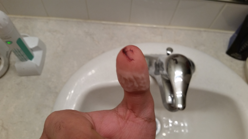 Illustration for article titled Thumb updateÂ